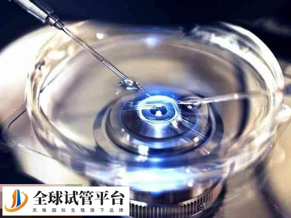 试管婴儿取卵是有创手术