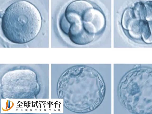 胚胎移植差会影响着床率