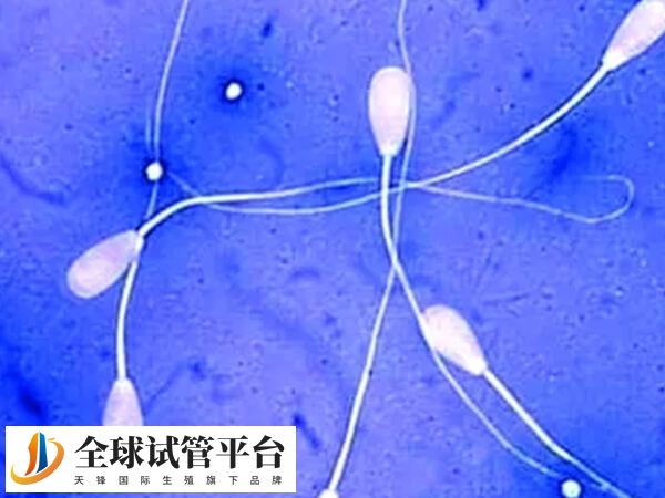 弱精子症可以做试管婴儿