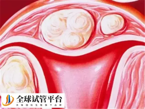 移植子宫内膜的厚度在20mm胚胎不易着床