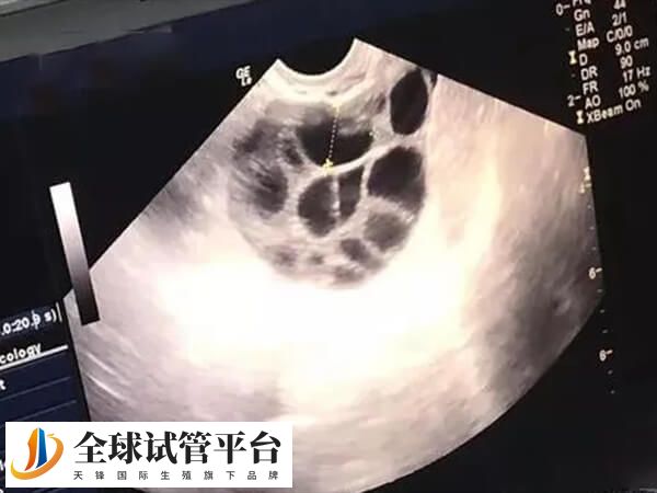 打促排针卵泡长得慢要及时就医