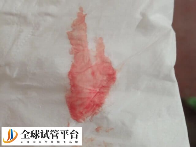 鲜胚移植着床成功会有少量出血