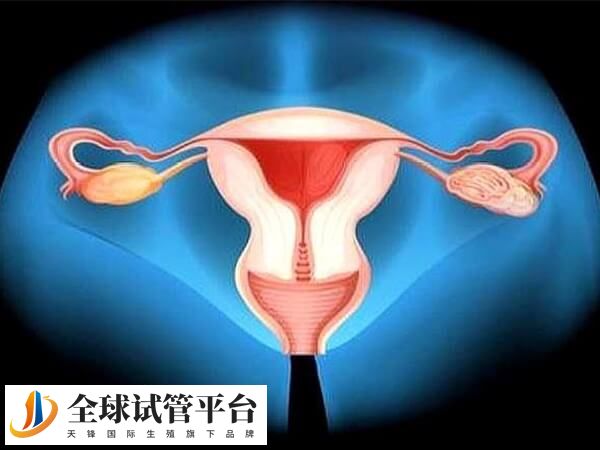子宫腺肌症会引起月经不调