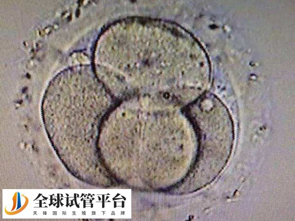 试管婴儿移植是一种常见的人工辅助生育技术