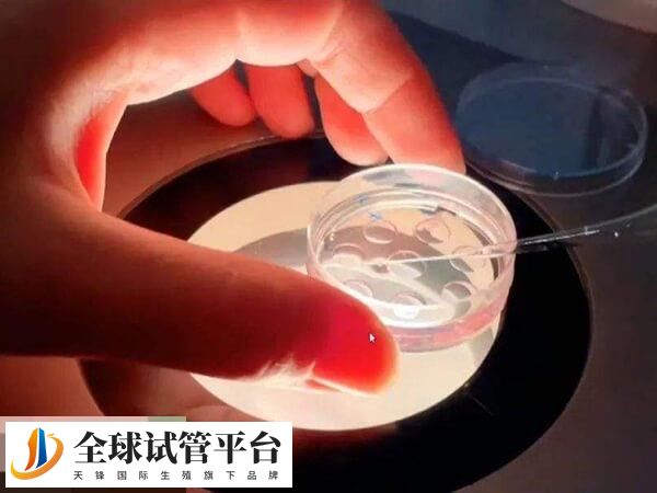 胚胎移植前会进行术前检查