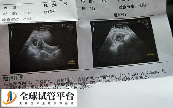 受孕时间比较短胎芽长得慢
