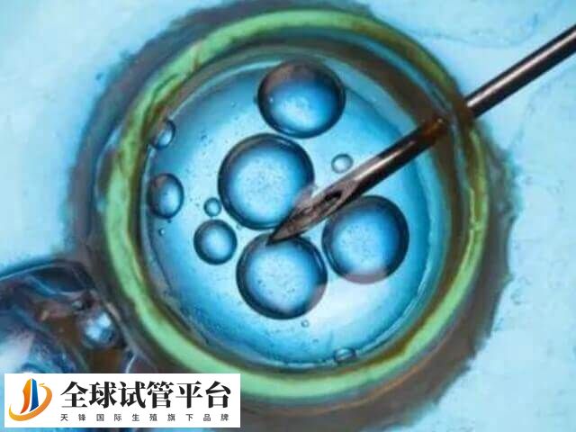 上海试管医院排名中前十名有哪些