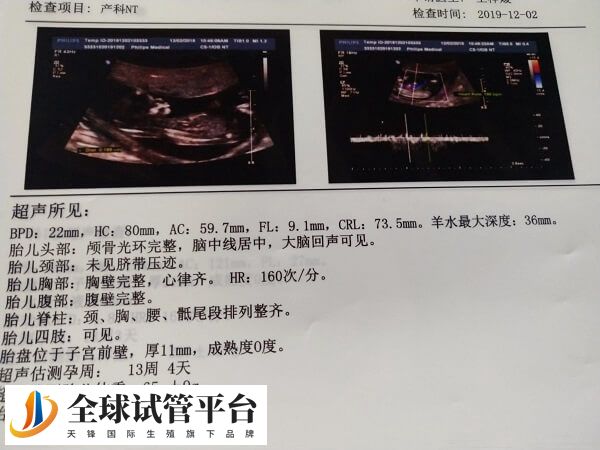 唐氏筛查可评估胎儿是否存在染色体异常