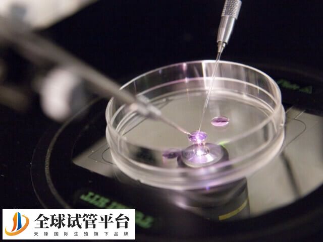 AZFc缺失做试管婴儿成功率大概有30%左右