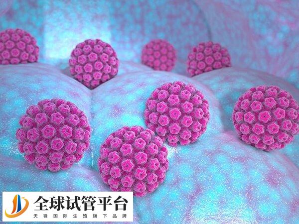 HPV是人乳头瘤病毒的缩写