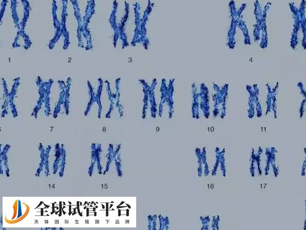 获得性免疫缺陷综合征简称艾滋病