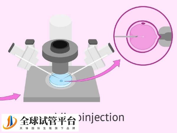 四代试管简称GVT