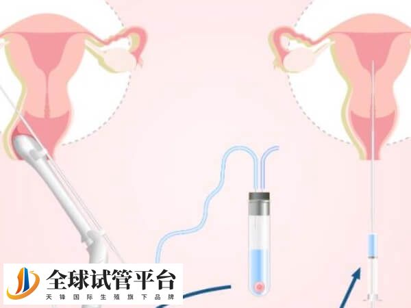 美国第四代试管婴儿能不能应用