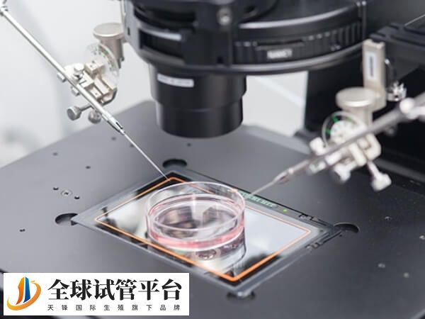 四代试管就是卵浆置换术