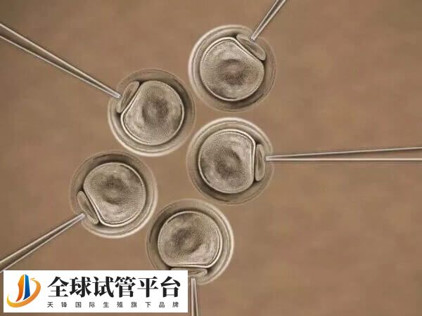 养囊移植成功率高