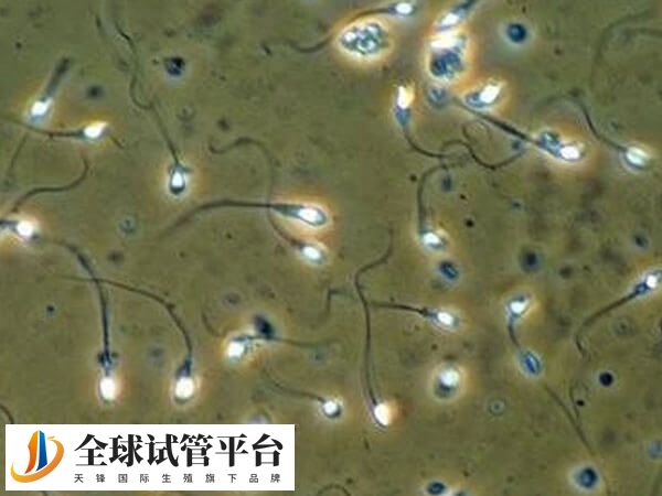 腮腺炎是会影响到生育的