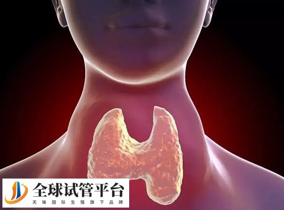 甲亢夫妇中的男性常伴有生精功能障碍