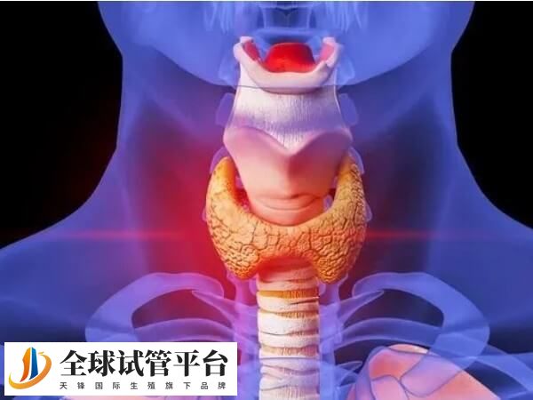 甲减是由于甲状腺激素分泌不足引起疾病