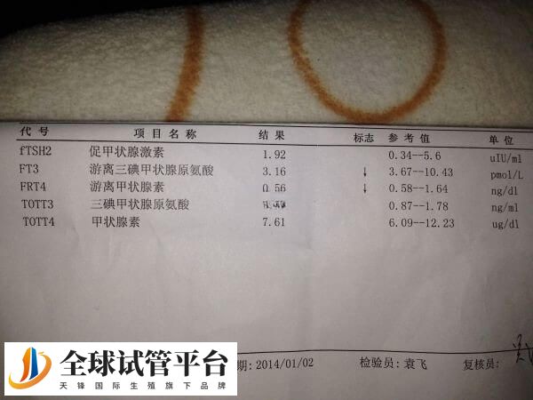 甲减就是甲状腺功能减退