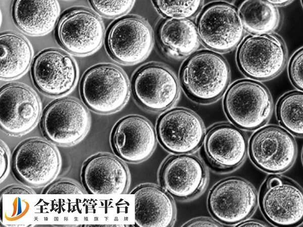 根据卵泡直径和激素水平判断拮抗剂添加时间