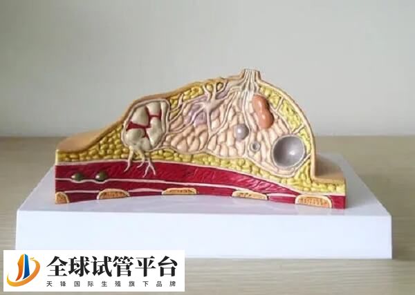 内膜异位对试管婴儿成功率有所影响