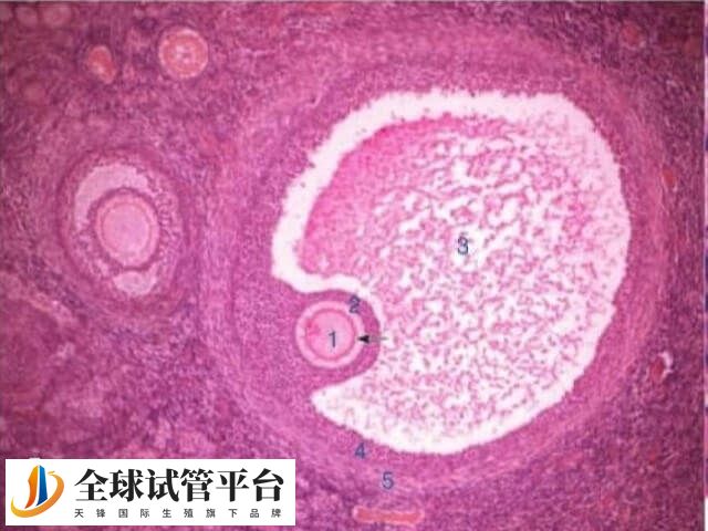 排卵后卵泡塌陷消失的时间因人而异