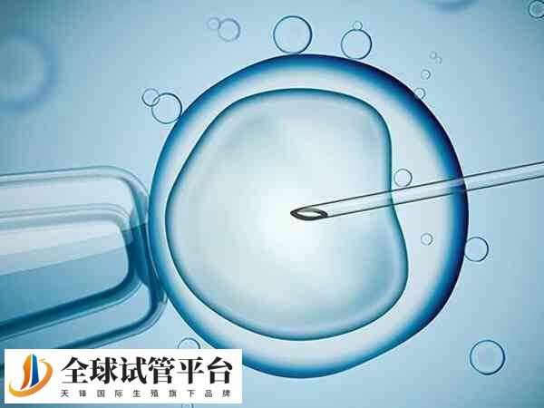 试管婴儿技术是一种辅助生殖技术