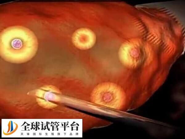 三代试管建议取卵8-18个区间内较为合理