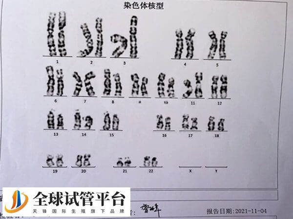 三倍体胚胎是一种可致生命受限的遗传畸变