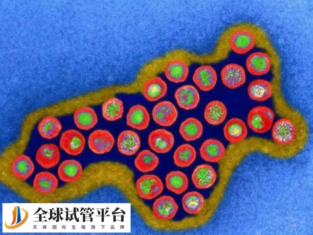 肾母细胞瘤是一种恶性肿瘤