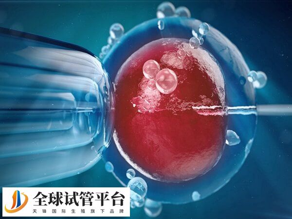 多胎妊娠本身属于高危妊娠