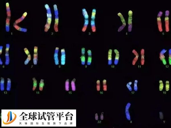 神经纤维瘤遗传概率约为50%