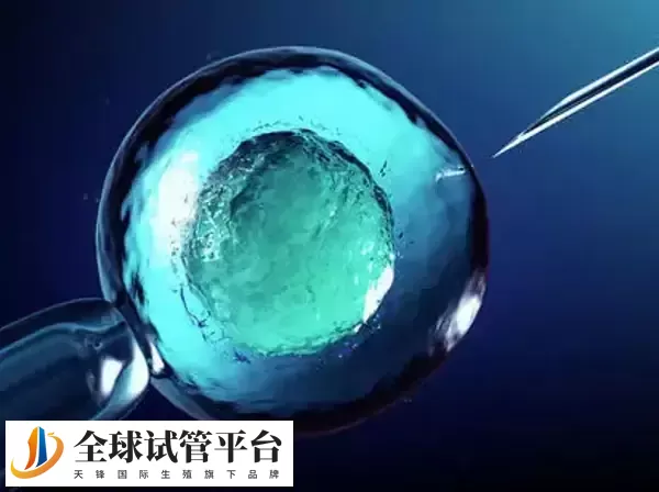 进行试管前建议查胰岛素抵抗