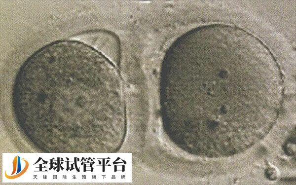 试管婴儿ivm成功率较低