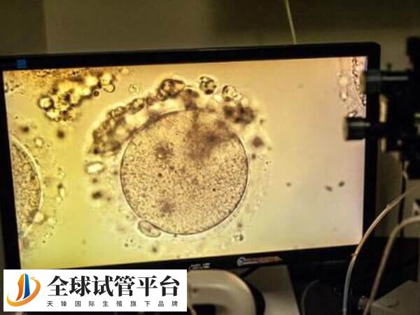 试管ivm是指未成熟卵母细胞体外培养技术