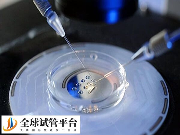 胚胎移植是试管婴儿的重要环节