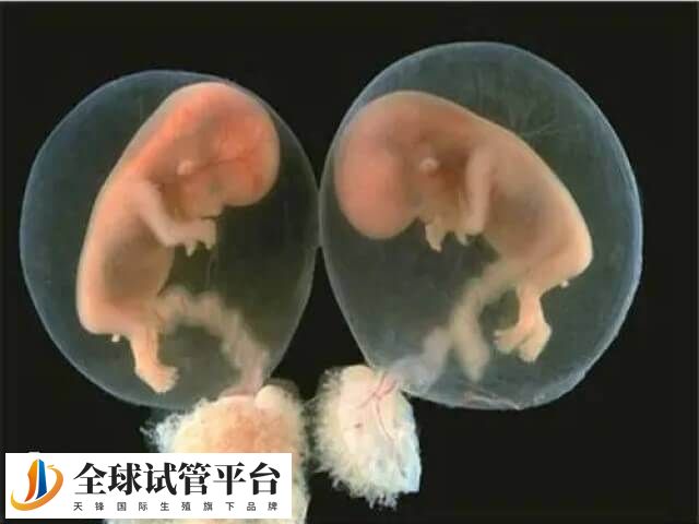 自然受孕怀双胞胎的几率小