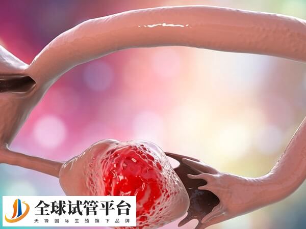 宫腔粘连是输卵管堵塞的原因之一