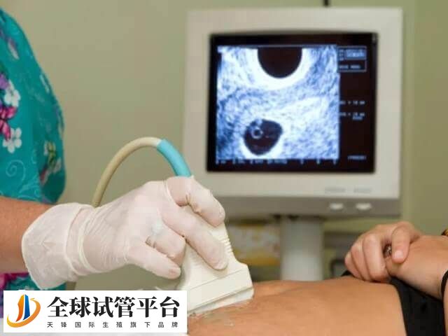 排卵障碍是监测不出卵泡的原因之一