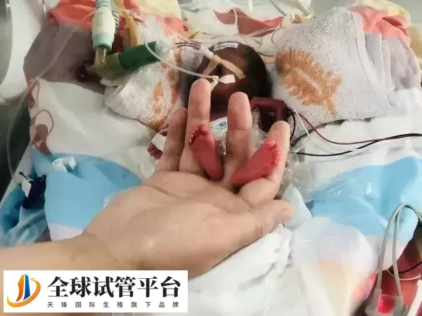 早产儿精心护理喂养后与健康宝宝没有差异