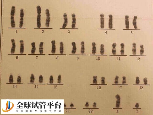 5号染色体是人类23对染色体中最五大染色体