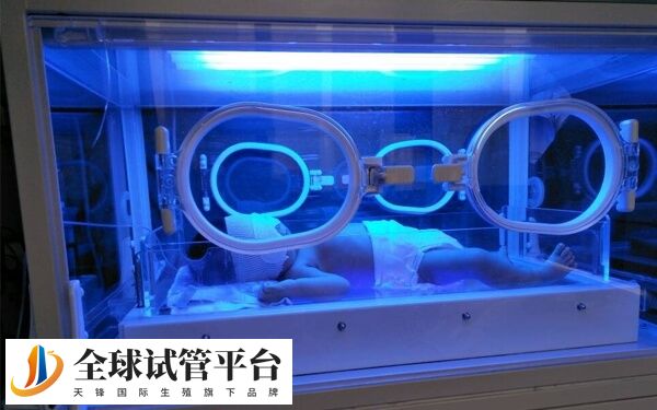 试管婴儿为什么容易得黄疸