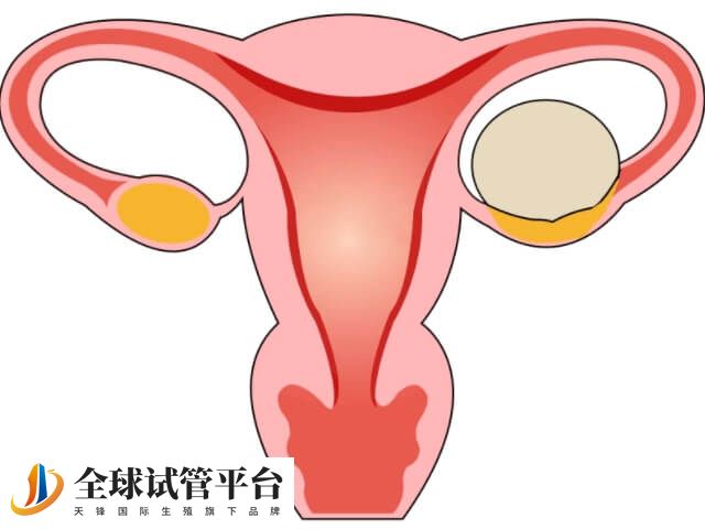 喜怒无常是卵巢功能衰退的表现
