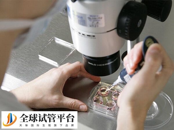 试管对amh值没有要求