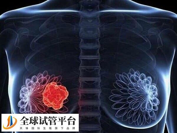 熬夜也是引起女性乳腺癌的原因之一