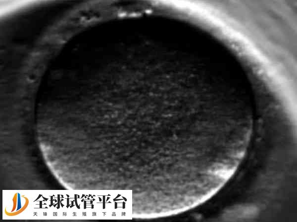 养囊可以提高受孕率