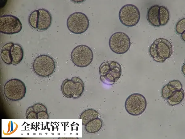 取卵后腹水能否移植鲜胚